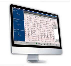 動態(tài)心電圖分析系統(tǒng)Cardio 8000 