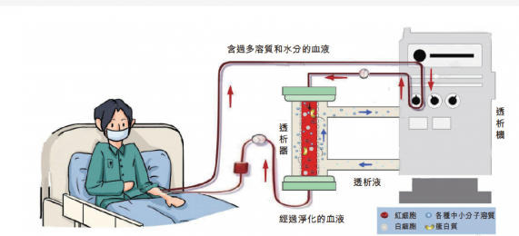 費森尤斯血液透析機：改善生活，重塑未來