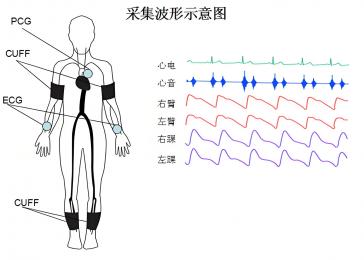 動脈硬化檢測儀的臨床意義，動脈硬化檢測儀的原理與技術(shù)！