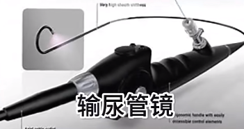 尿道鏡和膀胱鏡有什么區(qū)別？