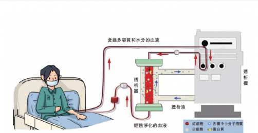 了解血液透析機(jī)的基本構(gòu)成、優(yōu)點和局限性
