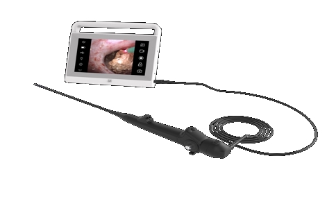 20250422_電子膀胱內(nèi)窺鏡_20250422_131454_1922